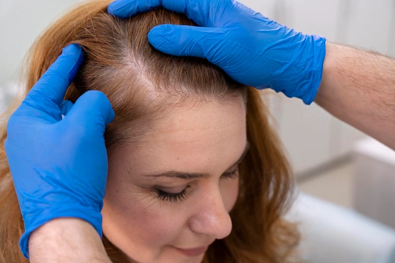 What is a hair filler?