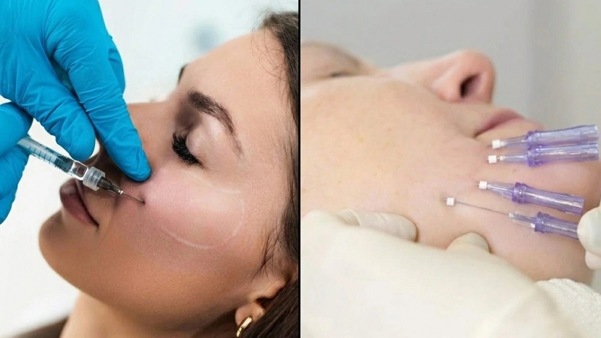 facelift with surgery vs botox