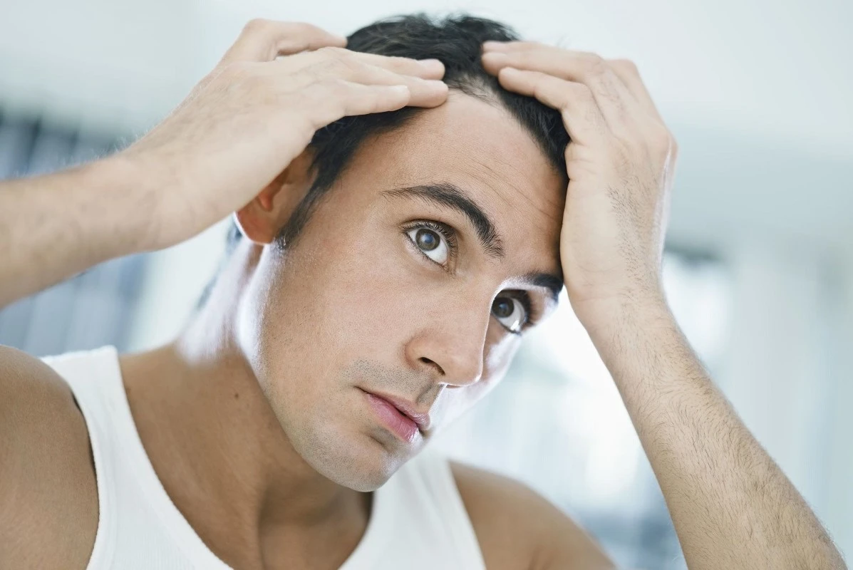 عوارض کاشت مو بعد از چند سال خود را نشان میدهد؟