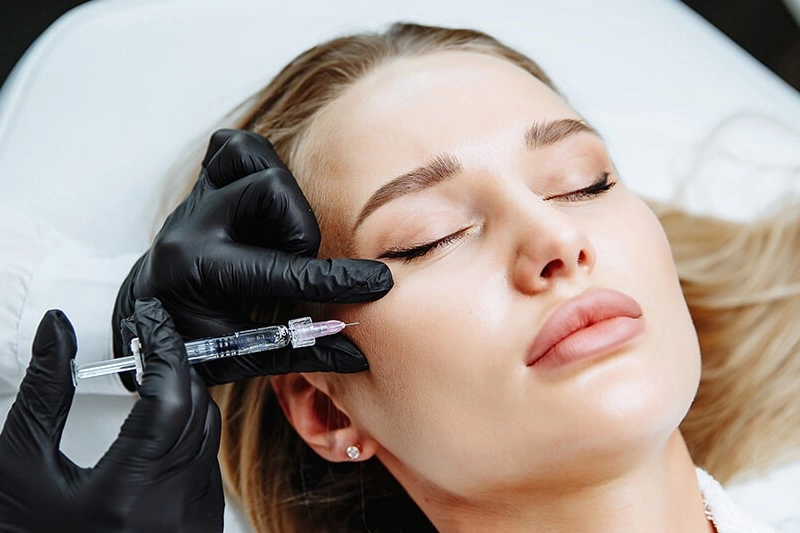 Facial Contouring with Fillers