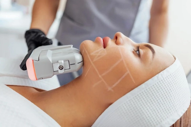 Factors Affecting the Longevity of Facial Contouring