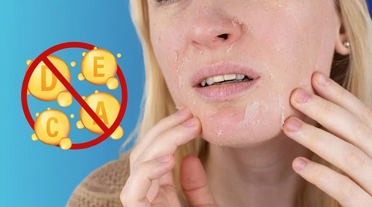 Dry skin and vitamin deficiency