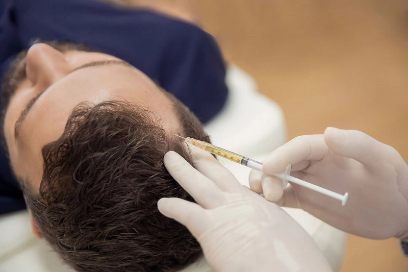 Pre-PRP care after hair transplantation