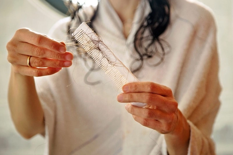 Symptoms of hair loss caused by polycystic ovaries