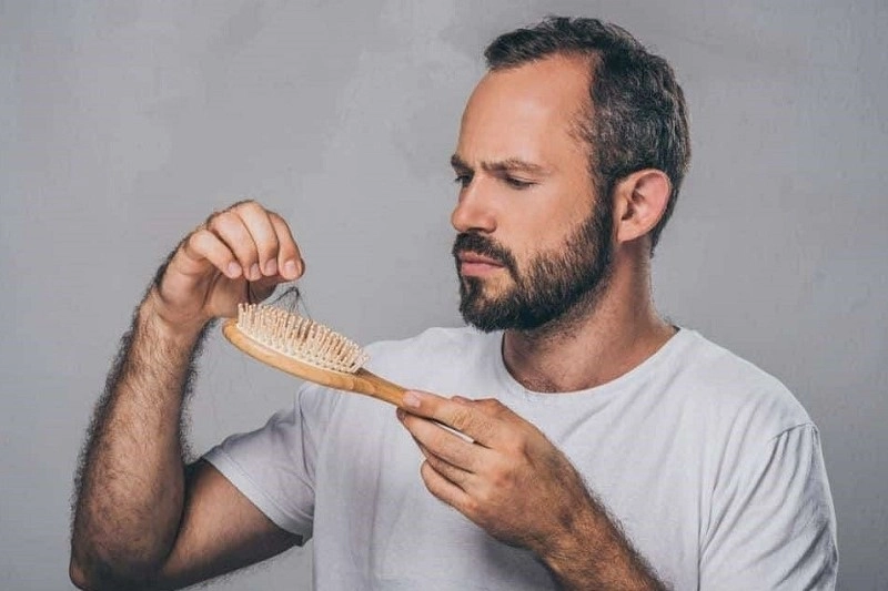 The best treatment for stress related hair loss