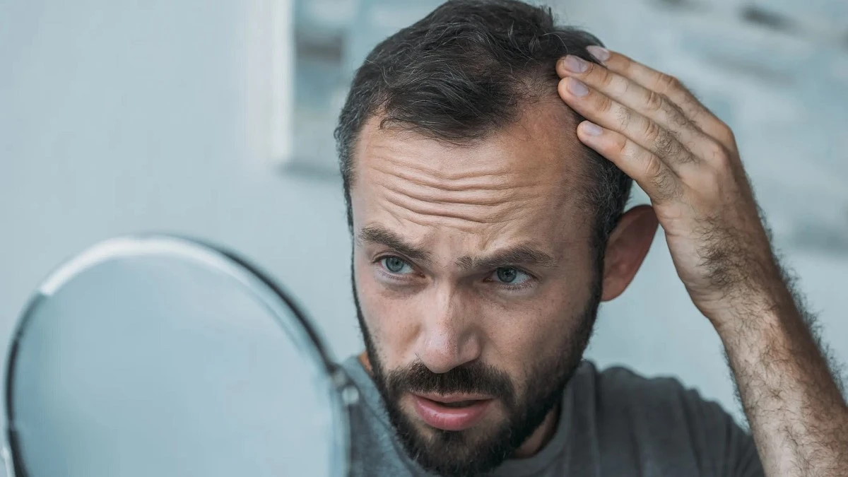 The effect of stress on hair loss