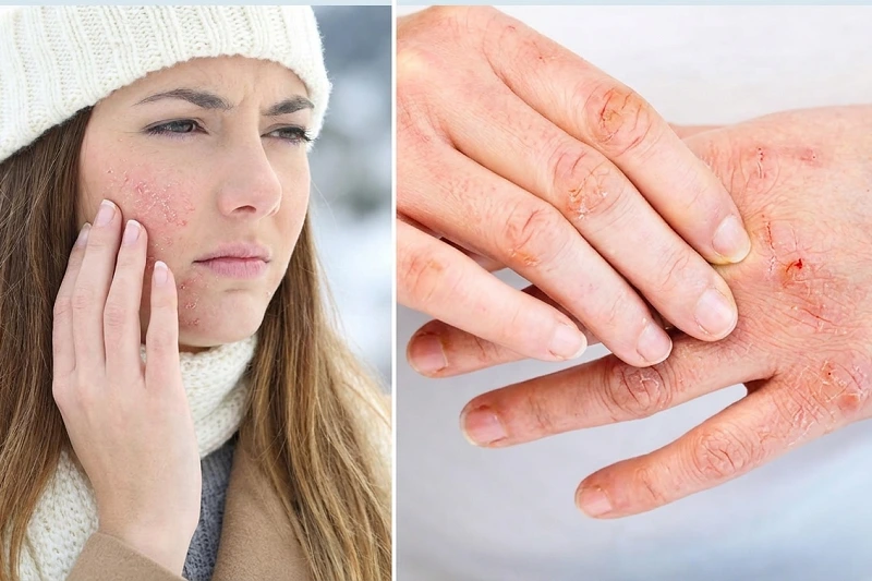 The link between dry skin and vitamin deficiency