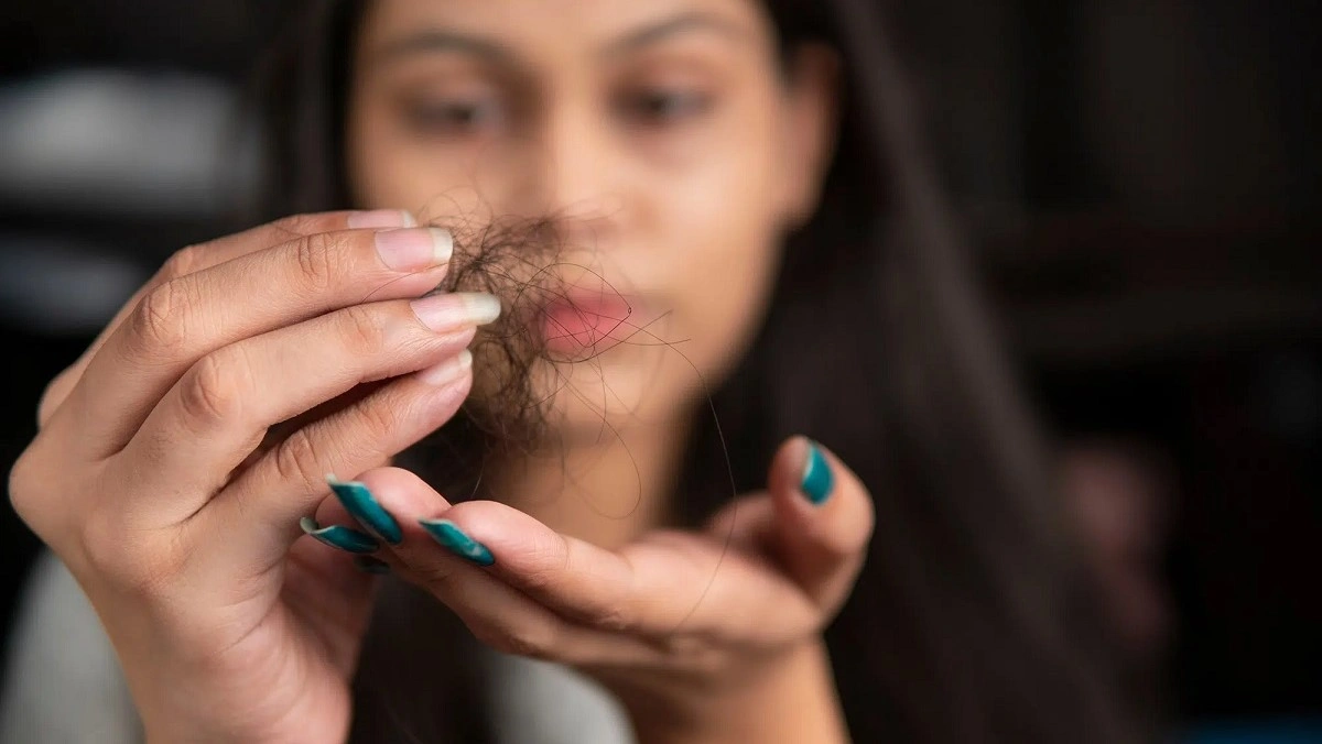 Hair loss caused by sluggish ovaries