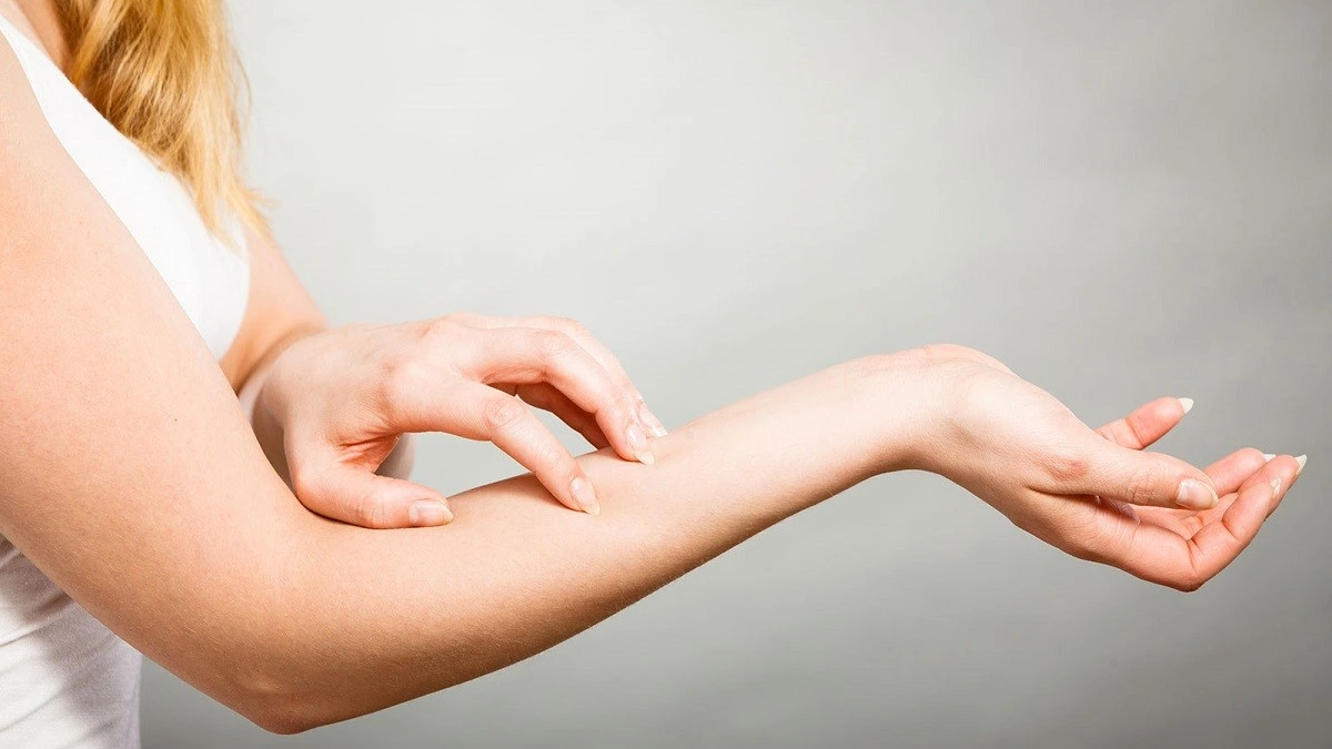 dry skin